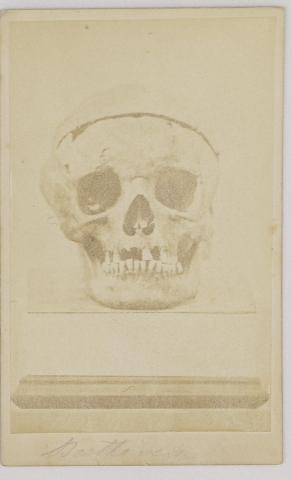 Ludwig van Beethoven koponyája - Johann B. Rottmayer fényképe 1863 Bécs 