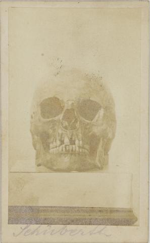 Franz Schubert koponyája - Johann B. Rottmayer fényképe 1863 Bécs 